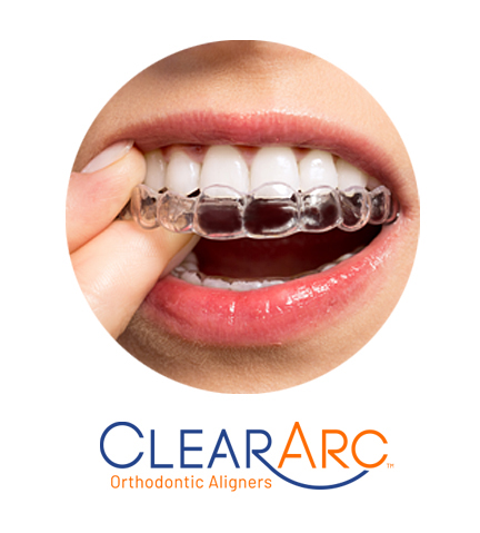 Invisible Aligners for Teeth | Brident